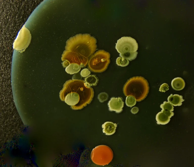 Colourful microbial colonies on a growth medium